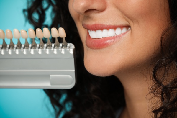Guidelines To Know If You Are A Candidate For Dental Veneers