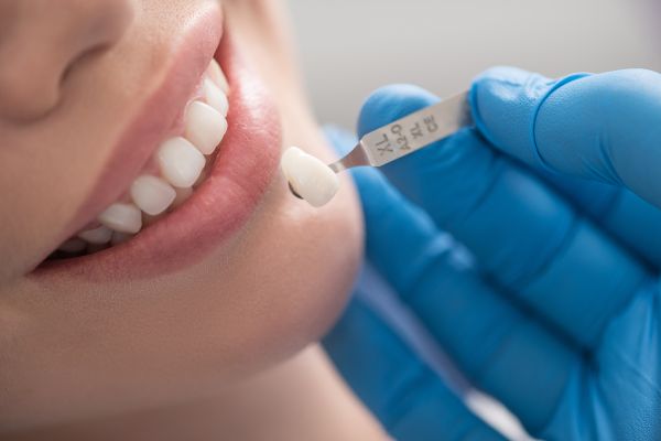 Dental Veneers: An Overview For People Debating Getting The Procedure