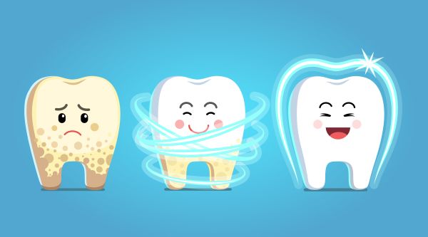 A Fluoride Treatment from Your General Dentist Can Help Prevent New  Cavities - Summit Dentist Summit New Jersey