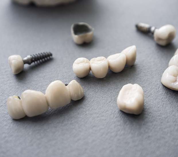Summit The Difference Between Dental Implants and Mini Dental Implants
